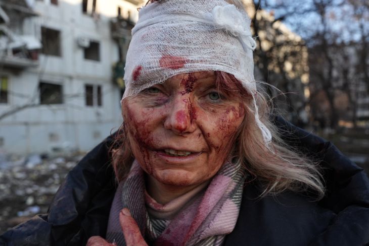 mujer-herida-guerra-ucrania-rusia_1.jpeg